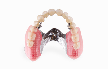rdent attachment