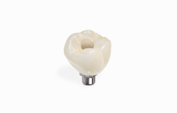 rdent crown restoration